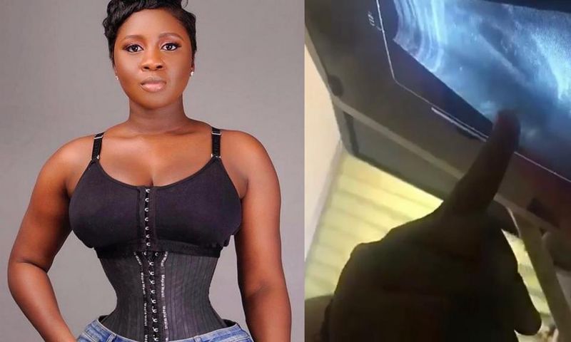 Princess Shyngle is pregnant according to this ultrasound scan