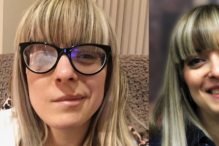 'Ramsay Hunt Syndrome Paralyzed Half My Face'