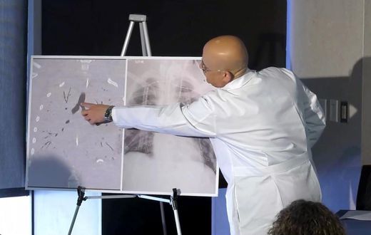Facing 'Certain Death,' Boy With Vaping Injury Gets Double Lung Transplant