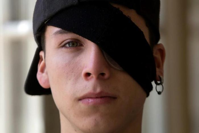 Student Carlos Vivanco lost the sight in his left eye during protests in Chile