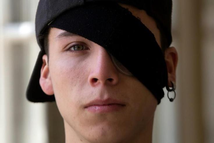 Student Carlos Vivanco lost the sight in his left eye during protests in Chile
