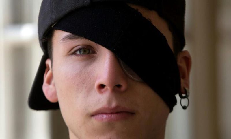 Student Carlos Vivanco lost the sight in his left eye during protests in Chile