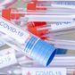 Are At-Home Novel Coronavirus Test Kits Accurate?