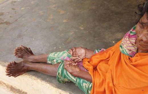 Woman with 31 fingers and toes chooses to live indoors as she’s branded a witch