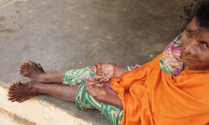 Woman with 31 fingers and toes chooses to live indoors as she’s branded a witch