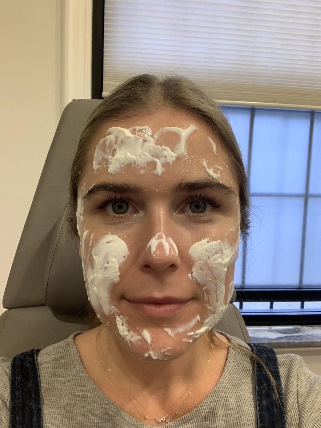 &quot;Microneedling made my skin softer than ever.&quot;