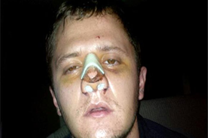 'El Menchito' Ruben Oseguera Gonzalez (pictured in 2015 apparently after plastic surgery) was number two in the powerful Jalisco New Generation drug cartel