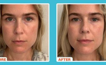 'This Fancy New Eye Cream Erased My Eye Bags'