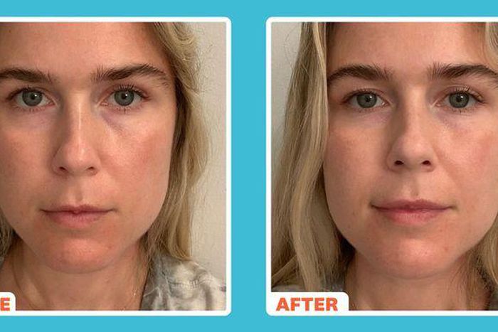 'This Fancy New Eye Cream Erased My Eye Bags'