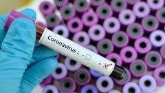 Ghana’s total COVID-19 case count has sharply risen to 313