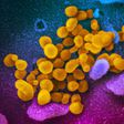This undated electron microscope image made available by the U.S. National Institutes of Health in February 2020 shows the Novel Coronavirus SARS-CoV-2, yellow, emerging from the surface of cells, blue/pink, cultured in the lab. Also known as 2019-nCoV...