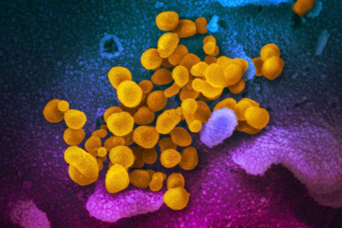 This undated electron microscope image made available by the U.S. National Institutes of Health in February 2020 shows the Novel Coronavirus SARS-CoV-2, yellow, emerging from the surface of cells, blue/pink, cultured in the lab. Also known as 2019-nCoV...