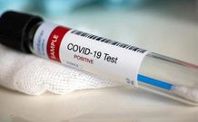 Coronavirus cases in Ghana have risen to 27, with two deaths