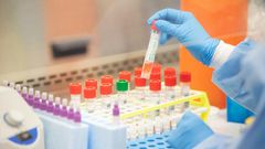 COVID-19: Compulsory house-to-house testing begins today in Ayawaso West