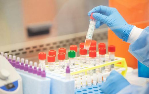 COVID-19: Compulsory house-to-house testing begins today in Ayawaso West