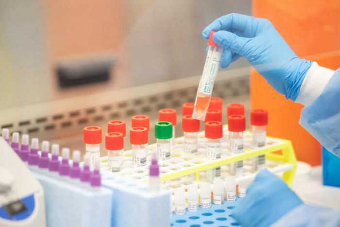 COVID-19: Compulsory house-to-house testing begins today in Ayawaso West