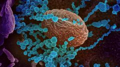 Sanning electron microscope image of the new coronavirus (round blue objects) emerging from the surface of cells cultured in the lab, courtesy of the The National Institutes of Health. The US has recorded more than 14,000 infections