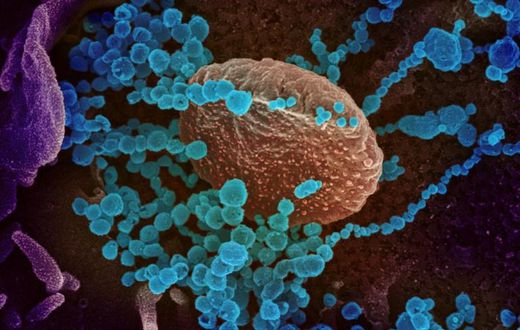 Sanning electron microscope image of the new coronavirus (round blue objects) emerging from the surface of cells cultured in the lab, courtesy of the The National Institutes of Health. The US has recorded more than 14,000 infections