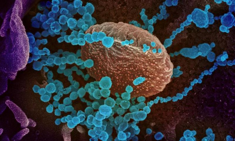 Sanning electron microscope image of the new coronavirus (round blue objects) emerging from the surface of cells cultured in the lab, courtesy of the The National Institutes of Health. The US has recorded more than 14,000 infections