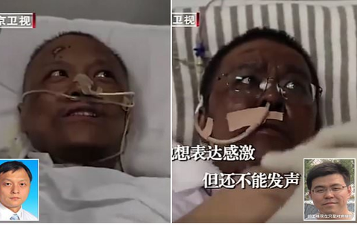 Chinese doctors turn black men after battling coronavirus (photos)