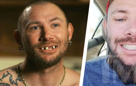 'Tiger King' Star John Finlay Has New Teeth