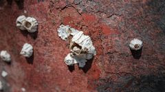 Watch Dr. P Punch Out Two Huge Neck Cysts