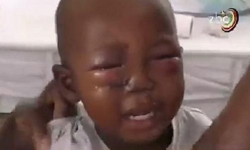 Brave woman injured as she wrestles with crocodile and rescues her son from its jaws