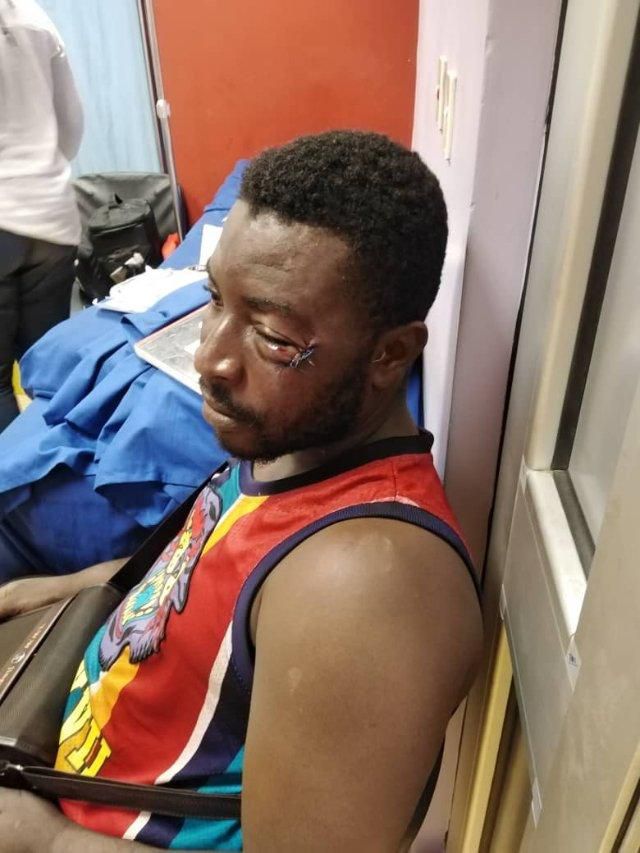 Assaulted spectator with a stitched eye