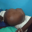 Ghanaian woman ‘pregnant’ with no baby is on the verge of death (video)