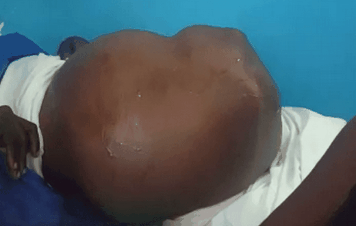 Ghanaian woman ‘pregnant’ with no baby is on the verge of death (video)