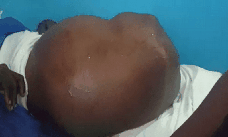 Ghanaian woman ‘pregnant’ with no baby is on the verge of death (video)