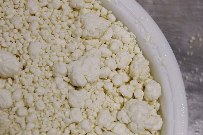 Dr. Pimple Popper Squeezes a 'Cheese' Cyst