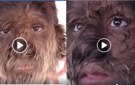 Boy’s rare condition leaves thick hair covering his entire face (video)