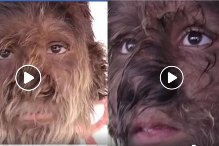 Boy’s rare condition leaves thick hair covering his entire face (video)