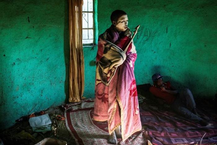 Twice a year, hordes of teenage boys from South Africa's tribal groups undergo ritual circumcision, deemed a rite of passage to manhood