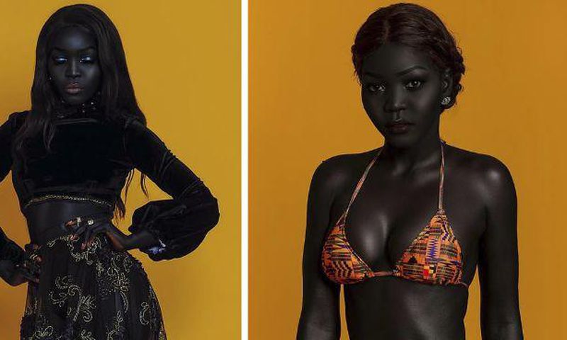 Dark and proud refugee turns a famous model 'by mistake' and promoting diversity