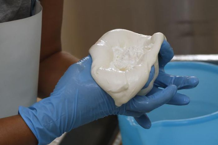 Dr. Pimple Popper Squeezes 'Cheesy' Steatocystomas