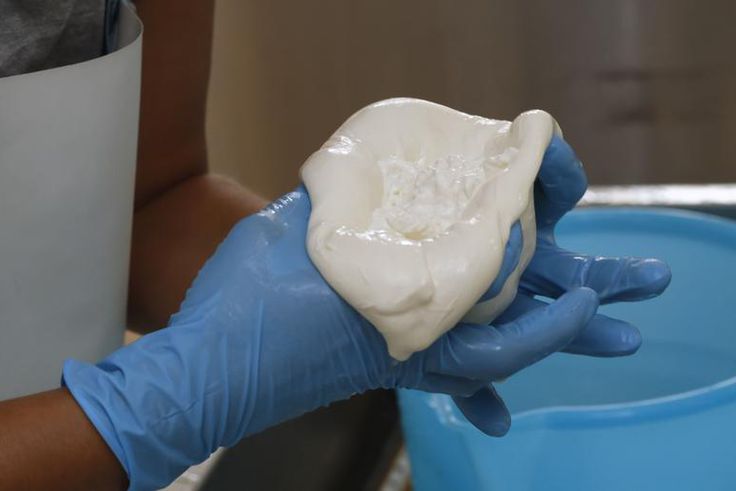 Dr. Pimple Popper Squeezes 'Cheesy' Steatocystomas