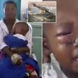 Brave woman injured as she wrestles with crocodile and rescues her son from its jaws