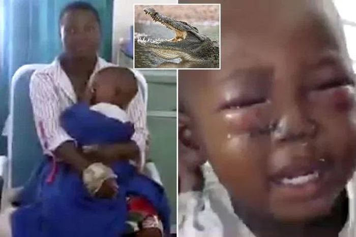 Brave woman injured as she wrestles with crocodile and rescues her son from its jaws