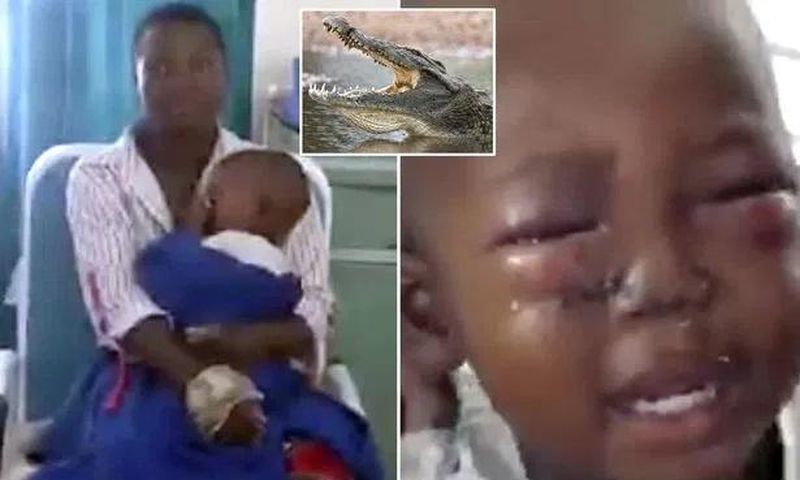 Brave woman injured as she wrestles with crocodile and rescues her son from its jaws
