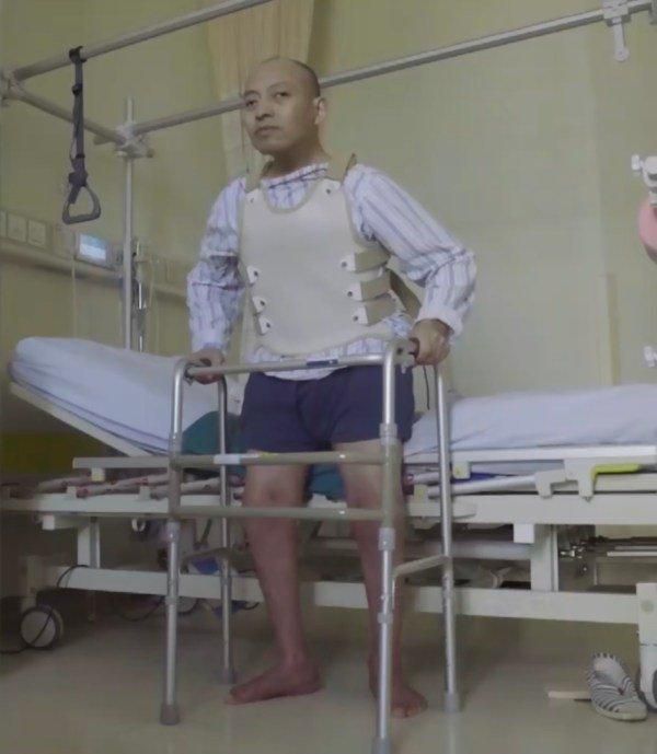 Medical condition makes this man spend 3 decades of his life with his head stuck to his knees