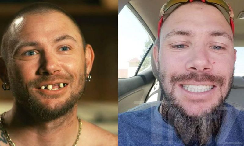 'Tiger King' Star John Finlay Got New Teeth