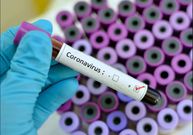 The Coronavirus is fast spreading to other countries