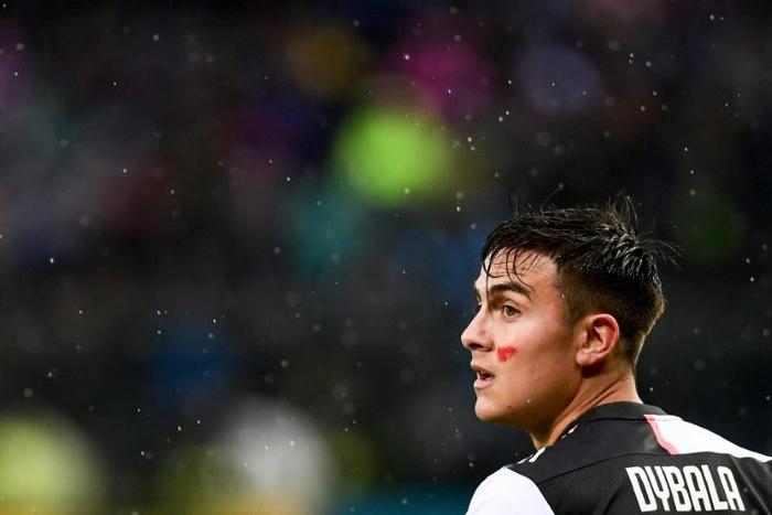Juventus forward Paulo Dybala had a red streak on his face to support an initiative targeting violence against women