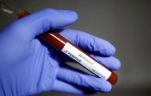 Ghana’s COVID-19 case count rises to 205 as Upper East records first case