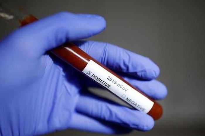 Ghana’s COVID-19 case count rises to 205 as Upper East records first case