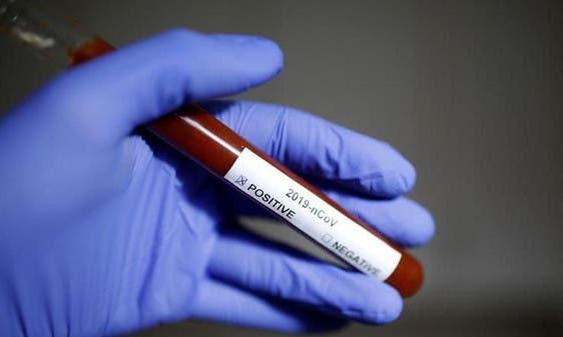 Ghana’s COVID-19 case count rises to 205 as Upper East records first case