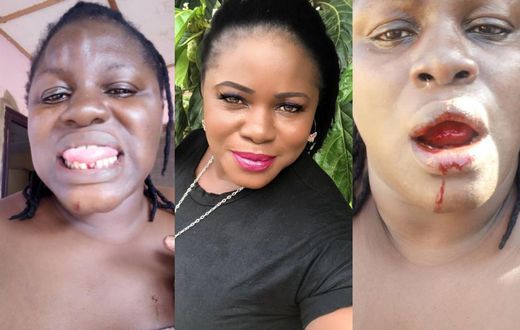 Ex-wife of Ayalolo Transport PRO makes damning allegations of serious physical abuse