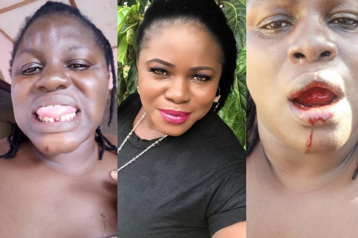 Ex-wife of Ayalolo Transport PRO makes damning allegations of serious physical abuse